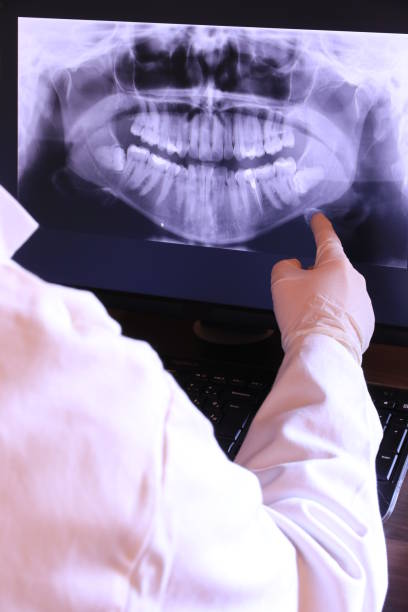 Best Emergency Wisdom Teeth Removal in Mendenhall, MS