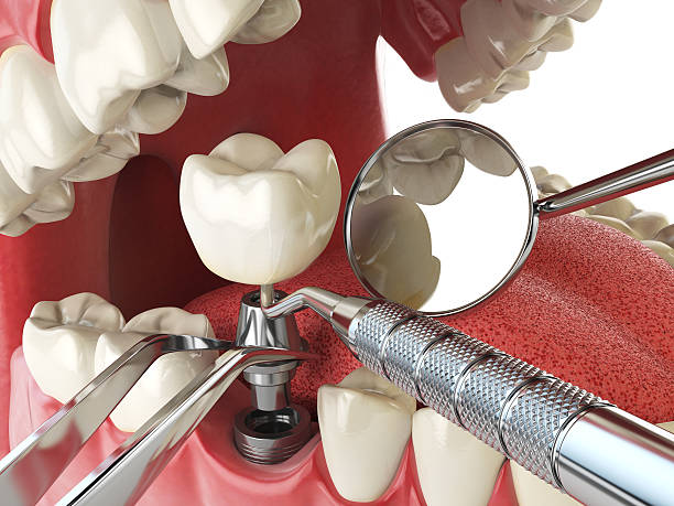 Fast & Reliable Emergency Dental Services in MS